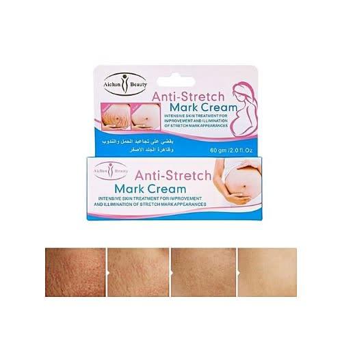 Radiant%20Skin%20Anti-Stretch%20Mark%20Miracle%20Cream%20-%2060gm%20Enriched%20with%20Natural%20Ingredients%20for%20Ultimate%20Skin%20Renewal%20-%20Image%202