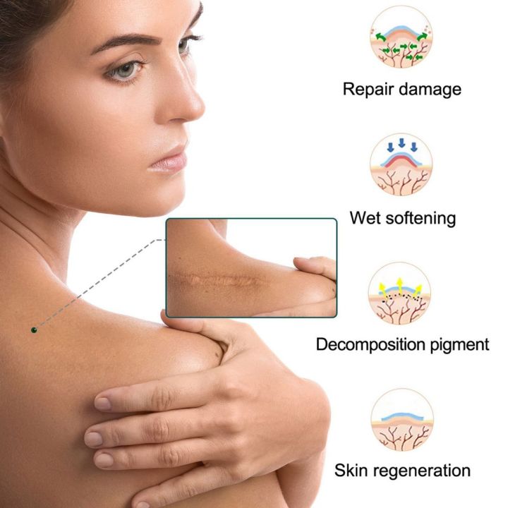%E3%80%90The%20Edge%20of%20Beauty%E3%80%91Scar%20Tape%20Efficient%20Surgery%20Gel%20Sheet%20Therapy%20Patch%20-%20Image%203