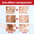 Dark spot remover cream, lightening body lotion, lightening melanin repair, moisturizing polish, quick shine, anti-fouling, skin care, Korean cosmetics. 