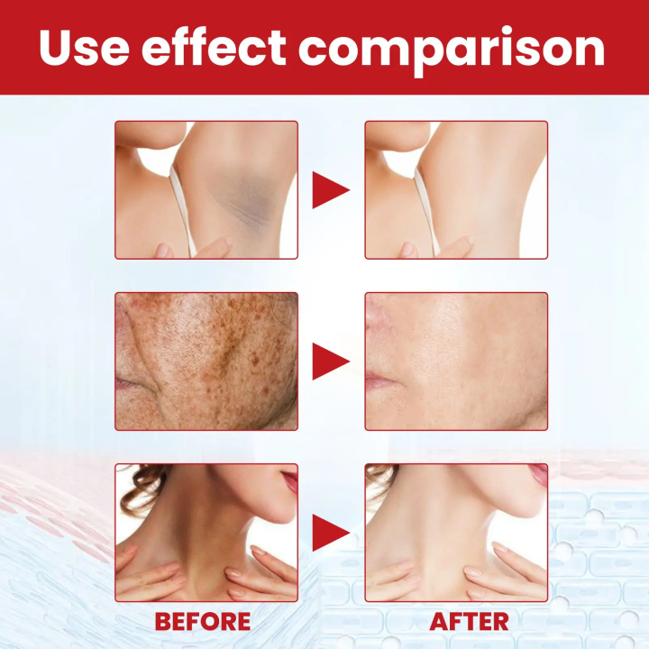 Dark%20spot%20remover%20cream,%20lightening%20body%20lotion,%20lightening%20melanin%20repair,%20moisturizing%20polish,%20quick%20shine,%20anti-fouling,%20skin%20care,%20Korean%20cosmetics%20-%20Image%203