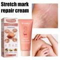 Stretch Mark Remover Cream With Coconut Sunflower Oil 50ml Natural Beeswax Maternity Skin Care Freckl Spot Repair Massage Lotion. 