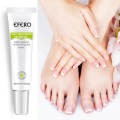 Efero Nail Repair Treatment Gel Fungus Cream-20gm  Bix super shop. 