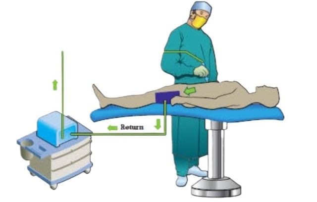 Diathermy%20Reusable%20Silicon%20Patient%20Plate/%20Negative%20Return%20Electrode/%20ESU%20Grounding%20Plate.%20-%20Image%207