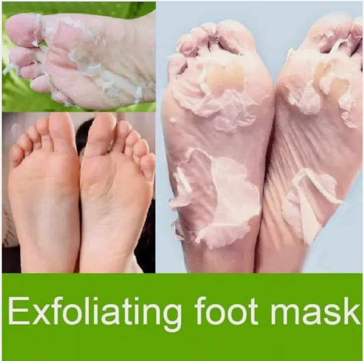 Exfoliating%20Peel%20Off%20Foot%20Mask%20Remove%20Hard%20Dead%20Skin%20Callus%20Sock%20Baby%20Soft%20Feet%20-%20Image%202
