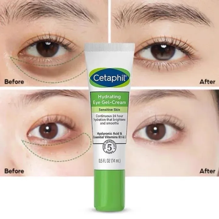 14ml%20Cetaphil%20Wrinkle%20Resistant%20Eye%20Cream%20Removes%20Puffiness,%20Dark%20Circles,%20Lightens%20Corners,%20Fine%20Lines,%20And%20Eye%20Care%20Products%20-%20Image%203