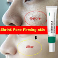 Salicylic Acid Pores Shrink Refining Cream Repair Large Open Pore Removal Black Dots Blackhead Acne Marks Facial Skin Care Serum.