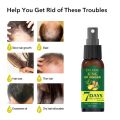 Ginger King Spray Hair Nutrient Liquid Hair Growth Liquid Growth Liquid Anti-Hair Loss Spray hair growth serum hair care. 