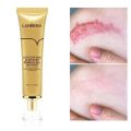 Lanbena - TCM Scar and Acne Mark Removal Gel Ointment - 30gm. 