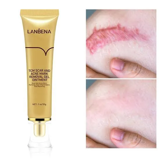 Lanbena%20-%20TCM%20Scar%20and%20Acne%20Mark%20Removal%20Gel%20Ointment%20-%2030gm%20-%20Image%205
