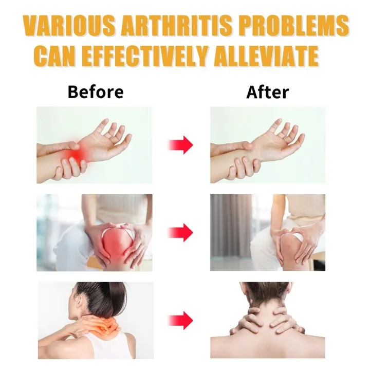 Beevenom%20New%20Zealand%20Bee%20Venom%20Professional%20Treatment%20Gel%20Relieve%20Arthritis%20Pain%20Promotes%20Joint%20Tissue%20Repair%20-%20Image%209