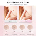 HEGRUS Face Mole Removal Pen Spots Tattoo Freckle Removal Pen LED Lighting Sweep Spot Mole Removing Dark Spot Remover Skin Care 9 Adjustable Modes Laser Mole Pen. 
