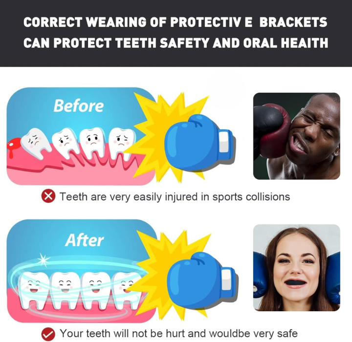 Badboy%20Pro%20Series%20MMA%20Mouthguard%20teeth%20protector%20Kids%20&%20Youth(%20upper%20and%20lower%20teeth%20gum%20)%20-%20Athletic%20Mouth%20Protection%20for%20Boxing,%20Football,%20Hockey,%20Karate,%20Rugby,%20Basketball%20-%20Custom%20Fit,%20Comfortable%20&%20Durable%20-%20Image%204