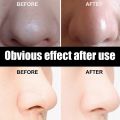 10pcs Nose Blackhead Remover Mask Skin Deep Cleansing Shrink Pore Nose Black Head Remove Stickers Skin Care Mask Patch AbandonA.