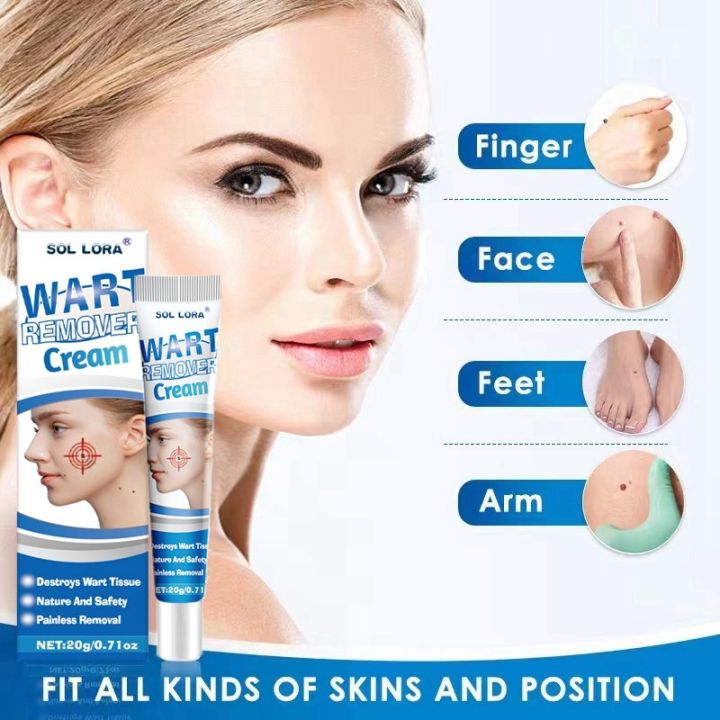 SOL LORA Aliexpress Amazon Cross-Border Wart Removing Cream Verruca Flat Corn Plaster Flat Verruca Flat Mole Remover Cream
