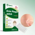 Tigerty Acne Patch – Targeted Treatment for Clearer Skin 144pcs. 