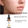 70% Glycolic Acid Chemical Peel Anti-Aging Brightening Smoothing Fine Lines Skin Pigmentation Acne Scars 30ml. 