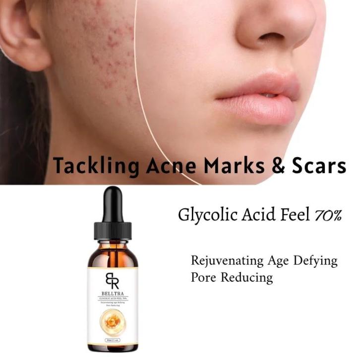 70%25%20Glycolic%20Acid%20Chemical%20Peel%20Anti-Aging%20Brightening%20Smoothing%20Fine%20Lines%20Skin%20Pigmentation%20Acne%20Scars%2030ml%20-%20Image%205