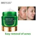 BREYLEE Acne Treatment Cream and Serum( 20g +17ml)-Acne Combo. 