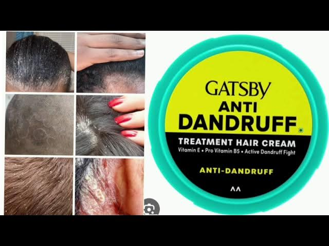 125%20gm%20Gatsby%20Anti%20Dandruff%20treatment%20hair%20cream%20International%20Indonesian%20product%20used%20for%20male%20-%20Image%203