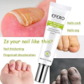 Efero Nail Repair Treatment Gel Fungus Cream-20gm  Bix super shop. 