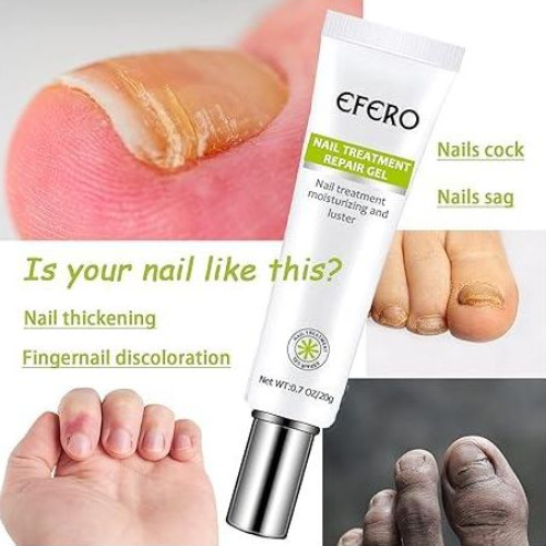 Efero%20Nail%20Repair%20Treatment%20Gel%20Fungus%20Cream-20gm%20%20Bix%20super%20shop%20-%20Image%206