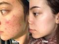AXIS-Y Dark Spot Correcting Glow Brightening Serum 50ml. 
