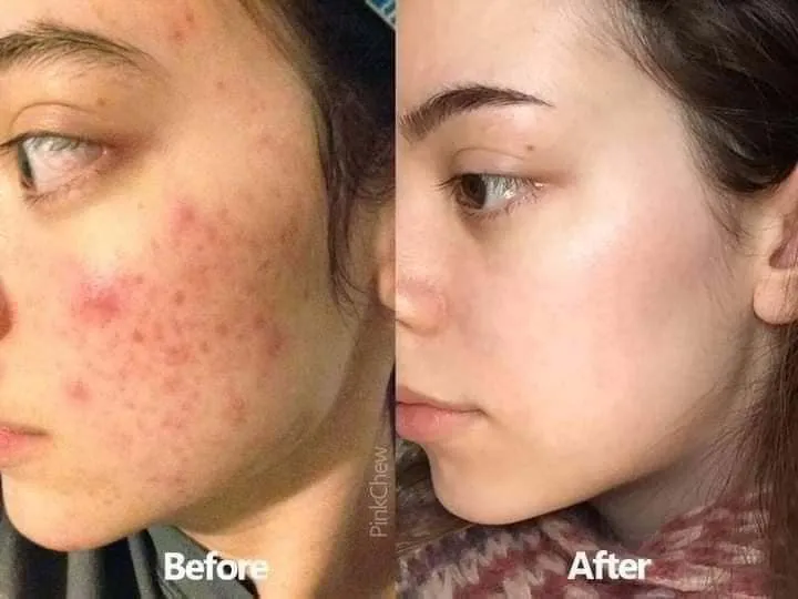 AXIS-Y%20Dark%20Spot%20Correcting%20Glow%20Brightening%20Serum%2050ml%20-%20Image%208