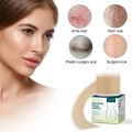 【Sleek】 Scar Sheets Patch Painless Scar Repair Tape Roll Effective Scar Removal Strips For C-Section Keloid Surgery Burn Acne.