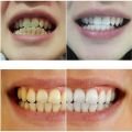80ml Magic Natural Teeth Whitening Powder Pearl Tooth Brushing Powder Physical Teeth Whitener Detoxifying Whitening Oralh Dental Oral Hygiene. 