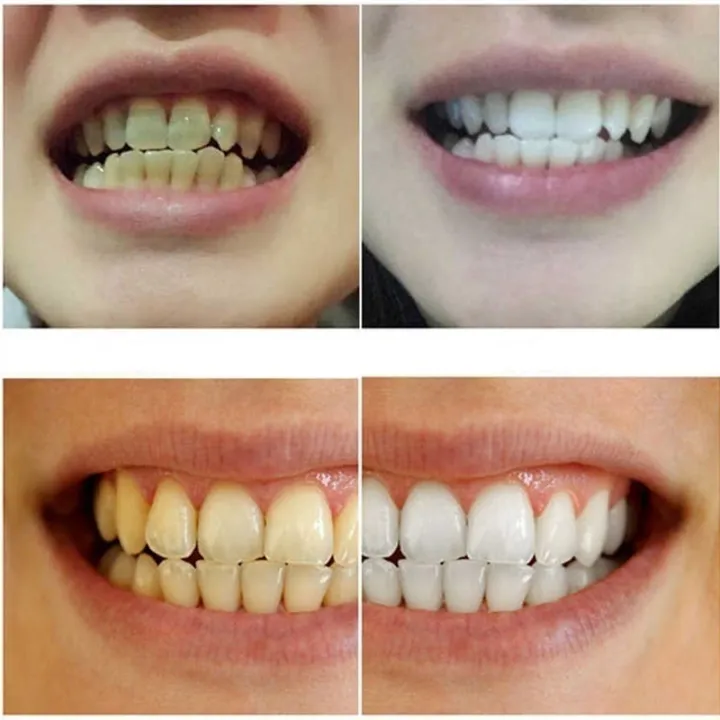 80ml%20Magic%20Natural%20Teeth%20Whitening%20Powder%20Pearl%20Tooth%20Brushing%20Powder%20Physical%20Teeth%20Whitener%20Detoxifying%20Whitening%20Oralh%20Dental%20Oral%20Hygiene%20-%20Image%208
