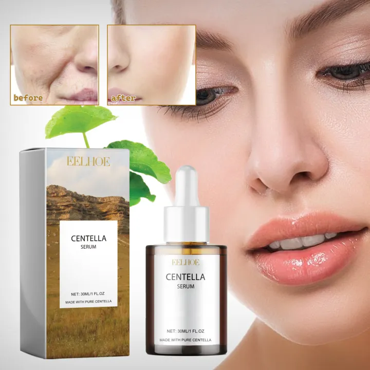 Centella%20Asiatica%20Facial%20Serum%20Moisturize%20Nourish%20Improvement%20Dry%20Skin%20Smoothing%20Rejuvenation%20Brightening%20Beauty%20Health%20-%20Image%204