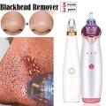 Rechargeable Electric Blackhead Remover Device - Black Head Remover. 