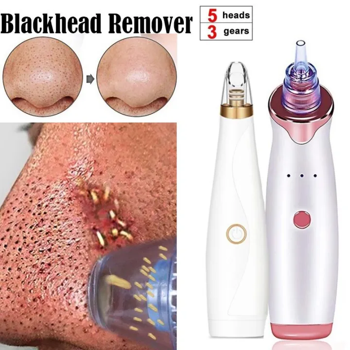 Rechargeable%20Electric%20Blackhead%20Remover%20Device%20-%20Black%20Head%20Remover%20-%20Image%203