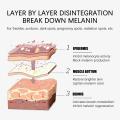 Effective Whitening Freckles Cream Remove Melasma Dark Spots Fade Pigmentation Moisturize Brighten Face Korean Skin Care Product. 