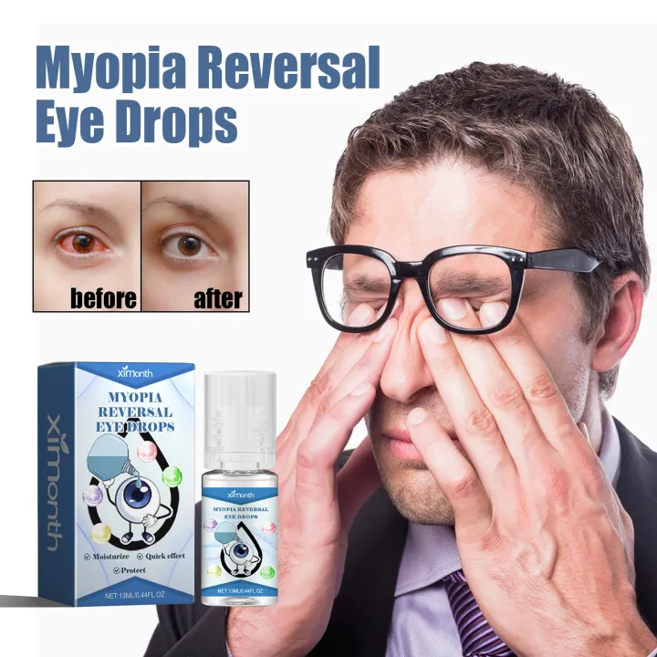 Myopia%20Reversal%20Eye%20Drops%20Improve%20Blurred%20Vision%20Relieve%20Eye%20Fatigue%20Dry%20Itchy%20Redness%20Cataract%20Treatment%20Eye%20Moisturizer%20Drops%20-%20Image%203