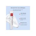 YOUBUY Whitening Freckle Cream Remove Dark Spots Anti Freckle Cream Niacinamide Fade Pigmentation Melasma Brighten. 