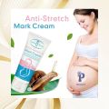 Aichun Beauty Anti Stretch Mark Cream – Intensive Skin Treatment for Improvement & Elimination. 