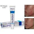 BIOAQUA Acne Scar Gel - Natural Blemish & Pimple Spot Removal Cream for Oil Control & Shrink Pores-30gm. 