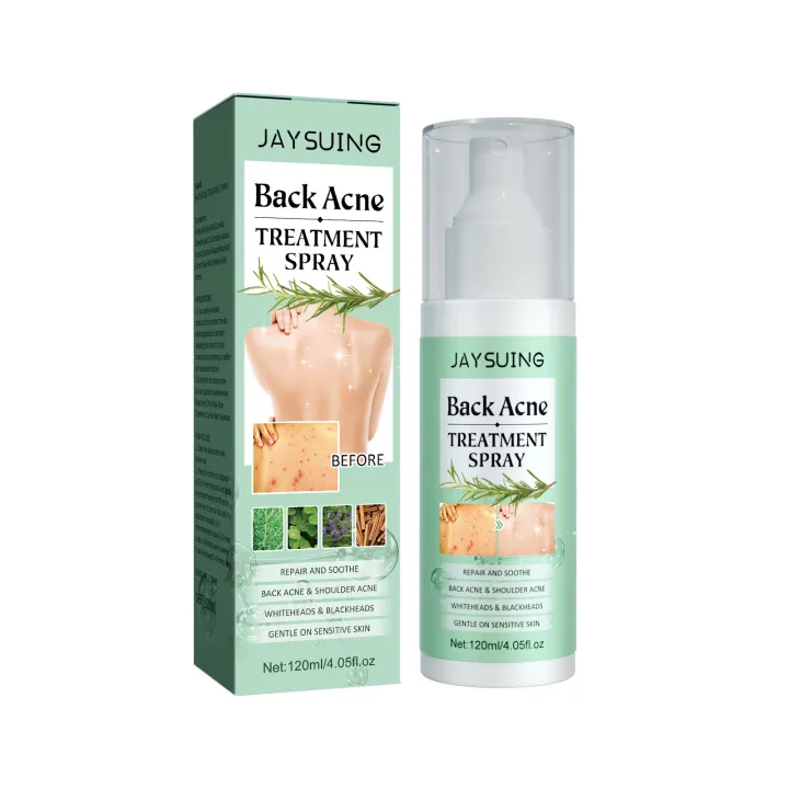 Back%20Acne%20Repair%20Spray%20Anti%20Pimples%20Marks%20Acne%20Spots%20Removal%20Oil%20Control%20Body%20Whitening%20Exfoliating%20Back%20Pimple%20Treatment%20Spray%20-%20Image%202