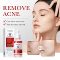 SADOER Fruit Acid AHA+BHA Acne Repair Serum- 30ml.