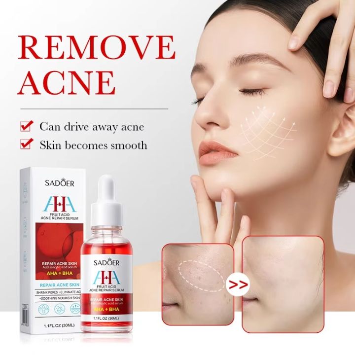 SADOER Fruit Acid AHA+BHA Acne Repair Serum- 30ml