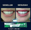 Orecare Chinese Herbal Toothpaste [hoichoi]. 