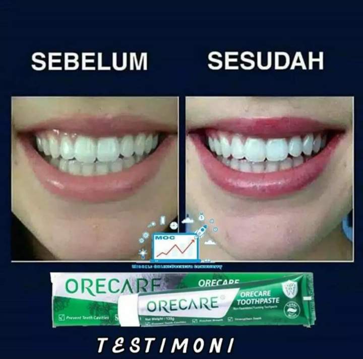 Orecare%20Chinese%20Herbal%20Toothpaste%20%5Bhoichoi%5D%20-%20Image%205