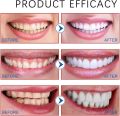 Sp-10 Probiotic Toothpaste,Whitening Toothpaste,Fresh Breath,Deep Cleaning Care. 