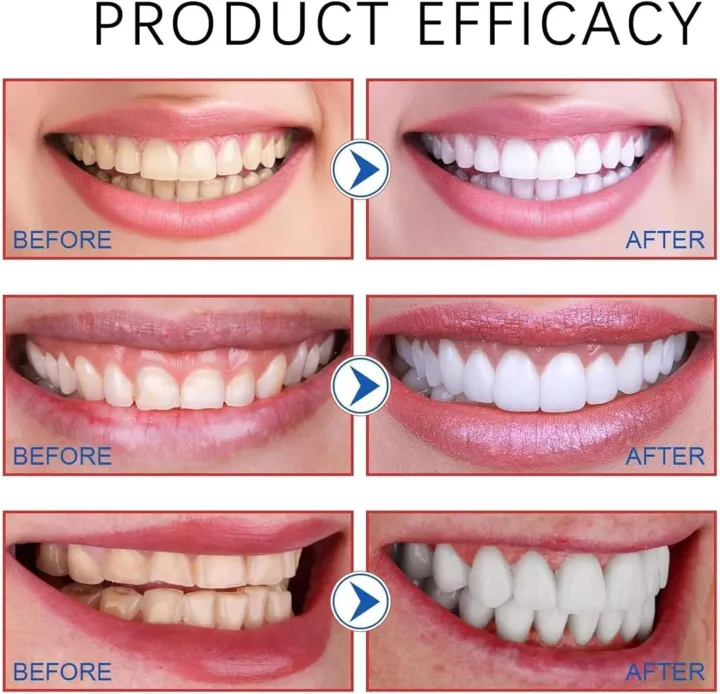 Sp-10%20Probiotic%20Toothpaste,Whitening%20Toothpaste,Fresh%20Breath,Deep%20Cleaning%20Care%20-%20Image%207
