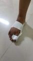 Bunion Splint Big Toe Straightener Corrector Foot Pain Relief Hallux Valgus Correction Orthopedic Supplies Pedicure Foot Care.