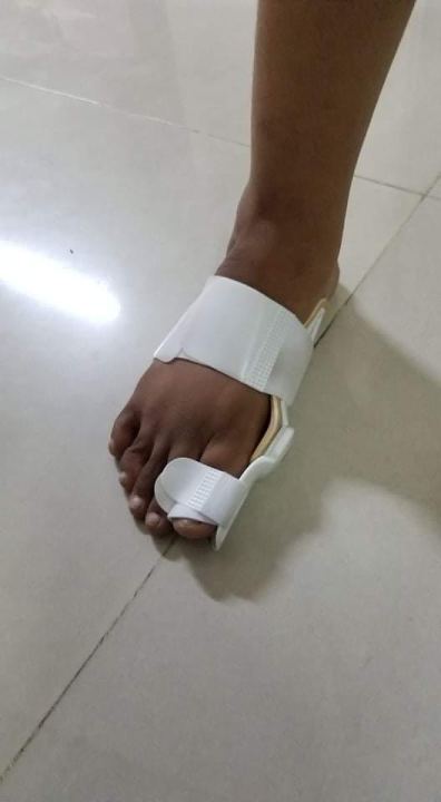Bunion%20Splint%20Big%20Toe%20Straightener%20Corrector%20Foot%20Pain%20Relief%20Hallux%20Valgus%20Correction%20Orthopedic%20Supplies%20Pedicure%20Foot%20Care%20-%20Image%205