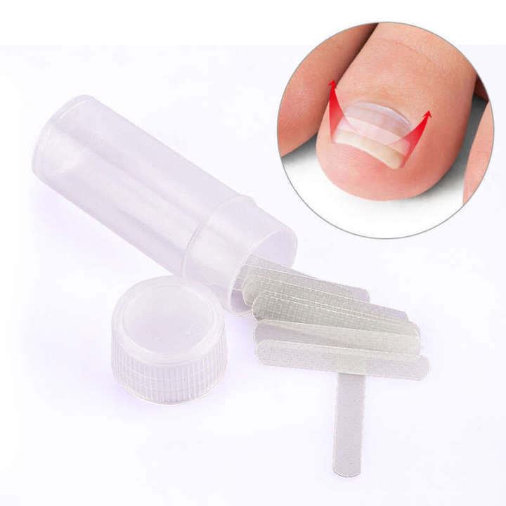 Orthodontic nail embedding patch anti pulling correction device ...