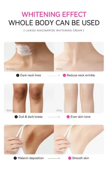 LAIKOU%20Niacinamide%20Whitening%20Lighten%20Spots,%20Moisture%20Cream-%20100g%20-%20Image%206