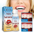 Temporary Tooth Repair Kit Teeth Gaps False Teeth Solid Glue Denture Adhesive brave. 
